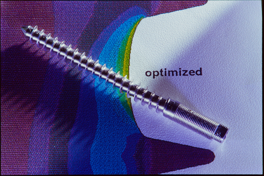 Knochenschraube "optimized" des Instituts für Materialforschung am Kernforschungszentrum Karlsruhe, entwickelt unter Übernahme von Universalformen aus der Natur nach Claus Mattheck, 13.08.1993, Fotografie unbekannter Urheberschaft. KIT-Archiv 28028/09818.